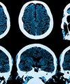 The Lundbeck Foundation is giving the DANDRITE neuroscience centre at Aarhus University DKK 75 M (EUR 10 M) to spend on research up to 2028. Photo: Colourbox